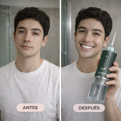 HydroPulse™ Irrigador bucal